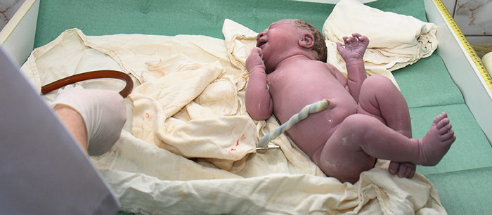 Donating umbilical cord blood